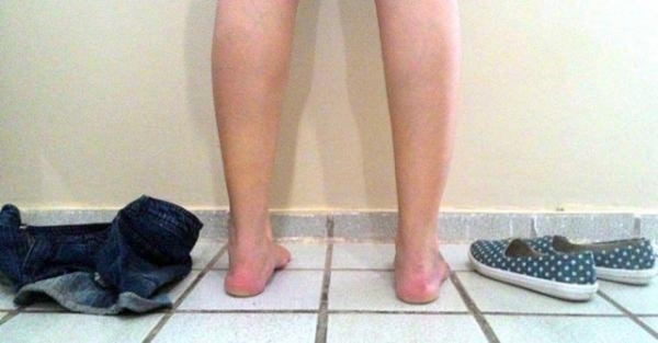 Avança na Câmara projeto que acaba com a revista íntima em presídios