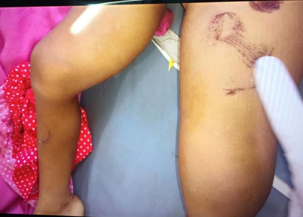 Suspeito de participar da tortura e morte da criança, em São Domingos do Maranhão, é apresentado