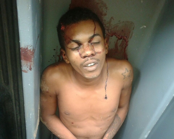 MA- Corpo de jovem morto no Plano da Serra em Açailândia  será sepultado como indigente.