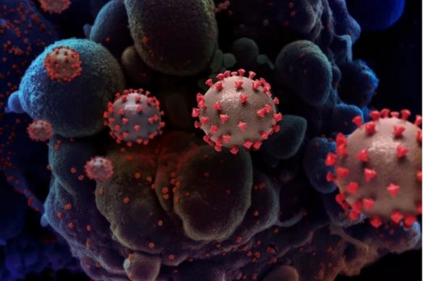 Maranhão chega a 417.031 casos e 10.838 mortes por Covid-19