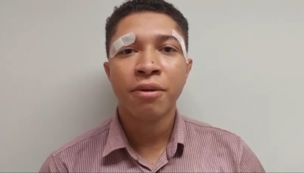 'Pensei que ia morrer', diz jovem negro agredido e apontado como ladrão do próprio carro no MA