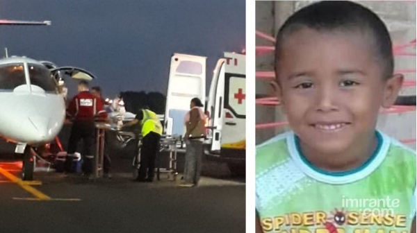 BURITICUPU- Morre em Goiânia criança que sofreu graves queimaduras em carvoaria no Maranhão