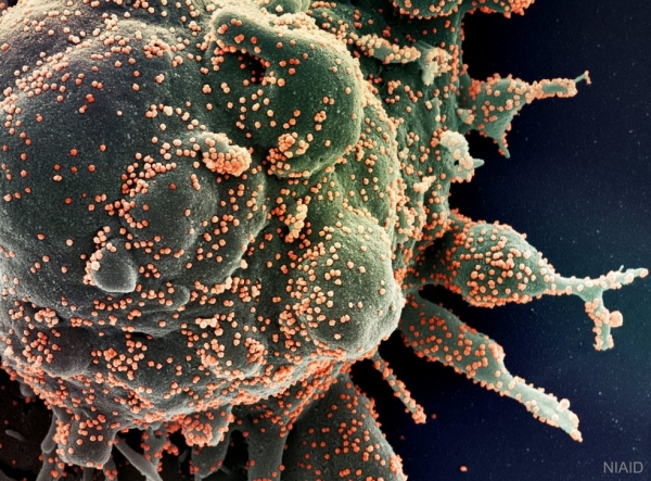 Maranhão tem 5.075 casos ativos da Covid-19 e já chegou a 3.796 mortes pela doença