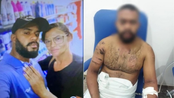 Suspeita de jogar ácido no rosto do companheiro no MA é presa no estado do Pará