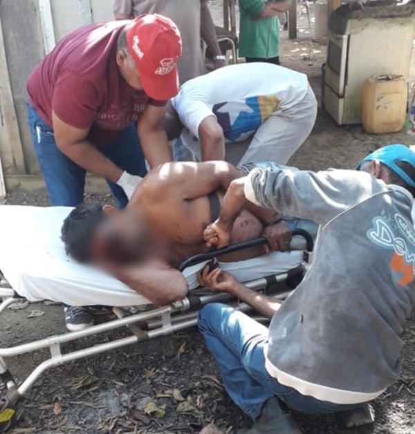 AÇAILÂNDIA URGENTE – Homem atira na própria cabeça em assentamento da cidade.