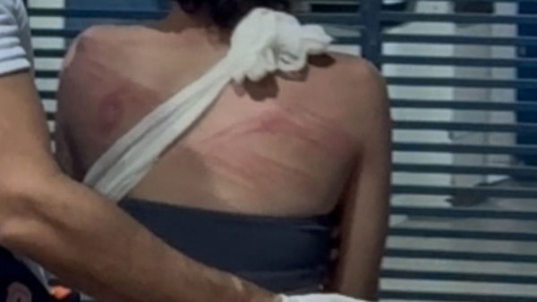  ADOLESCENTE É ATRAÍDA A CEMITÉRIO E ESPANCADA POR DUPLA EM IMPERATRIZ, NO MA