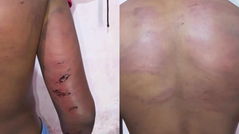  POLICIAL É PRESO POR SUSPEITA DE TORTURAR ADOLESCENTE NO MA; VÍTIMA NAMORAVA COM ENTEADA DE PM