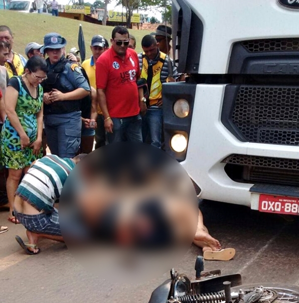 Mulher tem ‘Braço Esmagado’ em grave acidente na BR-010, em Açailandia