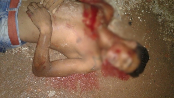 MA- Jovem é morto com pelo menos quatro tiros e namorada é baleada com um tiro no pé, em Açailândia.