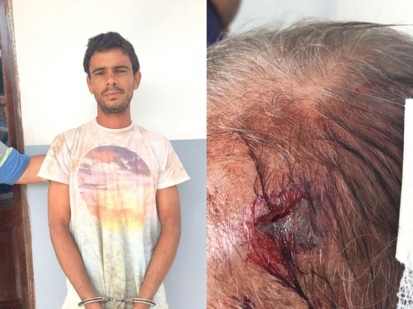 AÇAILÂNDIA - Polícia prende neto que agrediu avô com pedaço de pau