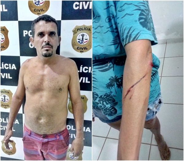 AÇAILÂNDIA – Homem agride esposa e acaba sendo preso no Residencial Aulídia