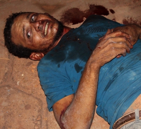 Suspeito de vários crimes é atingido com tiro na cabeça  em Açailândia