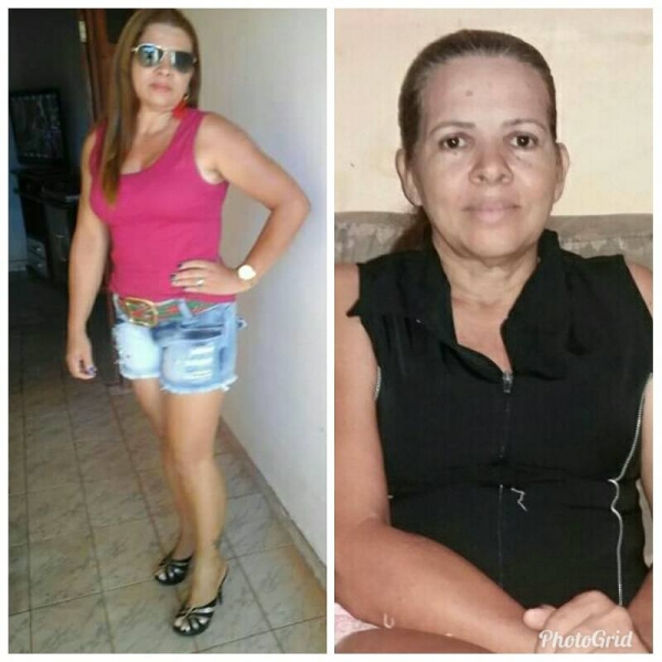 Açailandense precisa de ajuda para tratamento de saúde.