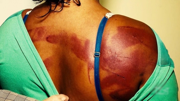 Aumentam casos de feminicídio no Maranhão