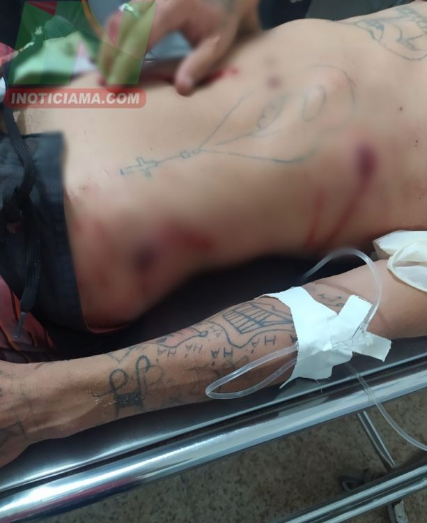 AÇAILÂNDIA – Homem é baleado na Vila Capeloza