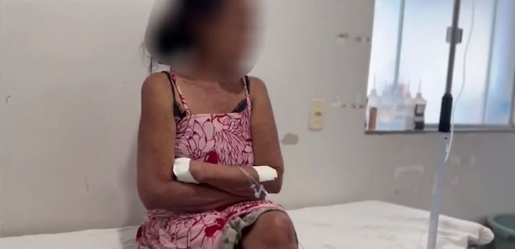 Bombeiros encontram idosa que desapareceu em mata no MA após sair para procurar gato