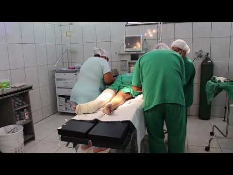 AÇAILÂNDIA - Prefeitura  realiza  entrega de  mesa Ortopédica Radiotransparente para cirurgia no Hospital Municipal 