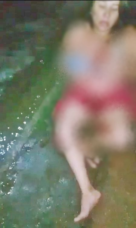 AÇAILÂNDIA - Mulher é esfaqueada seis vezes pelo seu companheiro na Vila Ildemar